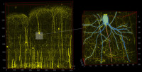 neuro1.jpg