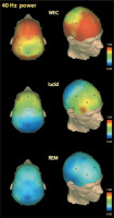 eeg40.jpg