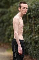 anorexim[1].jpg