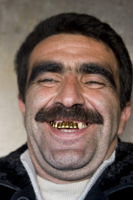 golden-teeth_3.jpg