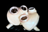 JARVIK_7_artificial_heart.jpg