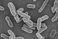 49-03-4-Yersinia-pestis-02_JPG.jpg